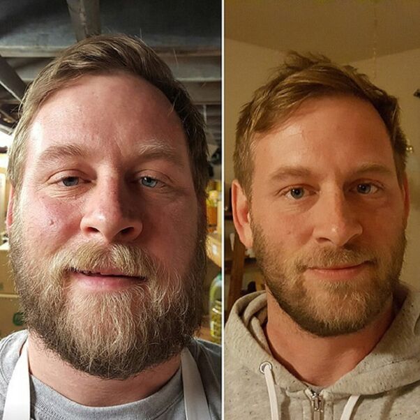 външния вид на човека преди и след отказ от алкохол